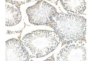 ABIN6258292 and ABIN6276010 at 1/100 staining Rat testis tissue by IHC-P. (GPR135 抗体  (Internal Region))