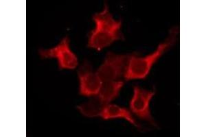 ABIN6276207 staining Hela by IF/ICC. (PRLHR 抗体  (Internal Region))