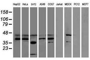 Image no. 2 for anti-Sulfotransferase Family, Cytosolic, 1C, Member 2 (SULT1C2) antibody (ABIN1501234) (SULT1C2 抗体)