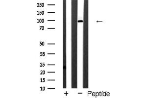 Western blot analysis of GluR4 expression in Jurkat cells