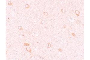 Immunohistochemical staining of human brain cells with CIITA polyclonal antibody  at 10 ug/mL. (CIITA 抗体  (N-Term))