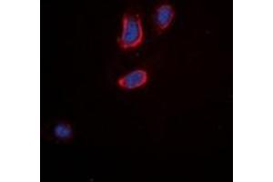 Immunofluorescent analysis of Tachykinin Receptor 3 staining in A549 cells. (TACR3 抗体  (C-Term))
