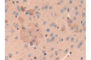 IHC-P analysis of Mouse Cerebrum Tissue, with DAB staining. (Cathepsin L 抗体  (AA 18-113))