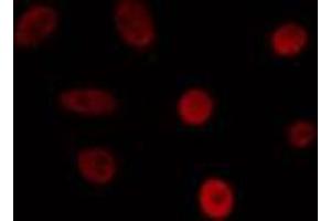 ABIN6274468 staining 293 cells by IF/ICC. (ISL2 抗体  (Internal Region))