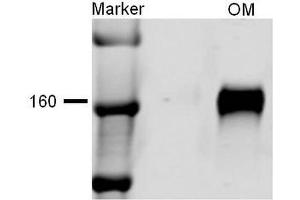 Western blot analysis of Rat kidney tissue lysates showing detection of NKCC2 protein using Rabbit Anti-NKCC2 Polyclonal Antibody . (SLC12A1 抗体  (AA 33-55) (Atto 390))