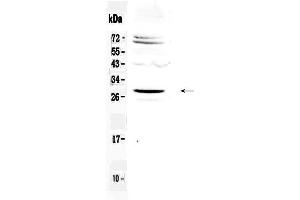 Western blot analysis of SIX6 using anti-SIX6 antibody . (SIX Homeobox 6 抗体  (AA 188-246))