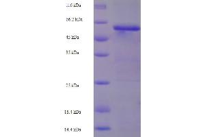 Keratin 17 (KRT17) (AA 1-441), (full length) protein (His-SUMO Tag)