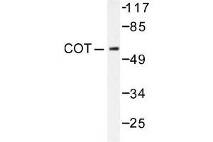 Image no. 1 for anti-Mitogen-Activated Protein Kinase Kinase Kinase 8 (MAP3K8) antibody (ABIN265369) (MAP3K8 抗体)