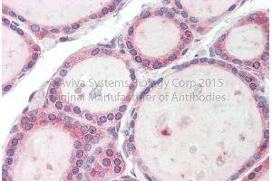 Rabbit Anti-TBC1D4 Antibody Catalog Number: ARP63880 Formalin Fixed Paraffin Embedded Tissue: Human Adult Thyroid  Observed Staining: Cytoplasm in hepatocytes Primary Antibody Concentration: 1:600 Secondary Antibody: Donkey anti-Rabbit-Cy3 Secondary Antibody Concentration: 1:200 Magnification: 20X Exposure Time: 0. (TBC1D4 抗体  (C-Term))
