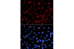 Immunofluorescence analysis of U2OS cells using SRSF1 antibody. (SRSF1 抗体)