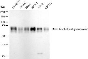 Western blotting analysis using Trophoblast glycoprotein antibody (ABIN7800648).