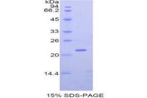 SDS-PAGE analysis of Human MMP12 Protein. (MMP12 蛋白)