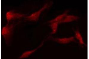 ABIN6274306 staining LOVO by IF/ICC. (Retinol Binding Protein 5 抗体)