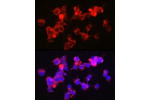 Immunofluorescence analysis of Neuro-2a cells using NPY5R Rabbit mAb (ABIN7268890) at dilution of 1:100 (40x lens). (NPY5R 抗体)