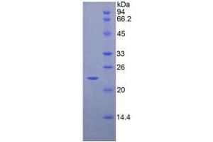 SDS-PAGE analysis of Rat CD8b Protein. (CD8B 蛋白)