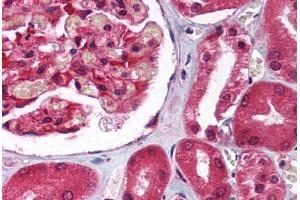 Immunohistochemistry (Paraffin-embedded Sections) (IHC (p)) image for anti-Guanine Nucleotide Binding Protein (G Protein), beta Polypeptide 2-Like 1 (GNB2L1) (C-Term) antibody (ABIN6736725)