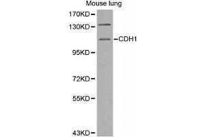 Western Blotting (WB) image for anti-Cadherin 1, Type 1, E-Cadherin (Epithelial) (CDH1) antibody (ABIN3023667) (E-cadherin 抗体)