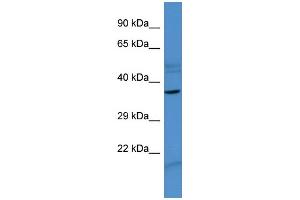 Host:  Rabbit  Target Name:  ZNF793  Sample Type:  MCF7 Whole cell lysates  Antibody Dilution:  1. (ZNF793 抗体  (N-Term))
