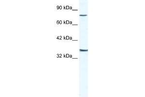 WB Suggested Anti-ZNF337 Antibody Titration:  2. (ZNF337 抗体  (Middle Region))