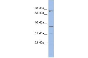 WB Suggested Anti-OLAH Antibody Titration: 0. (OLAH 抗体  (N-Term))