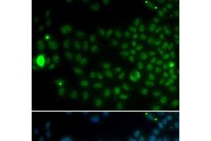 Immunofluorescence analysis of MCF-7 cells using SPDYA Polyclonal Antibody (SPDYA 抗体)