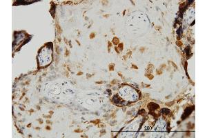 Immunoperoxidase of monoclonal antibody to TIMP2 on formalin-fixed paraffin-embedded human placenta. (TIMP2 抗体  (AA 27-220))