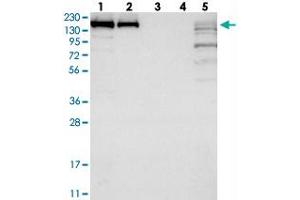 Western blot analysis of Lane 1: RT-4, Lane 2: U-251 MG, Lane 3: Human Plasma, Lane 4: Liver, Lane 5: Tonsil with SAMD9 polyclonal antibody  at 1:250-1:500 dilution. (SAMD9 抗体)