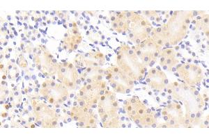 Detection of NUP88 in Mouse Kidney Tissue using Polyclonal Antibody to Nucleoporin 88 (NUP88) (NUP88 抗体  (AA 57-296))