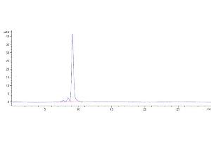 anti-SOST (Setrusumab Biosimilar) antibody