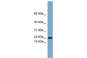 WB Suggested Anti-PRR13 Antibody Titration: 0. (Proline Rich 13 抗体  (Middle Region))