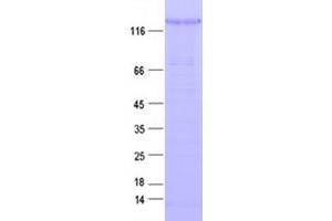 Western Blotting (WB) image for V-Erb-A erythroblastic Leukemia Viral Oncogene Homolog 4 (Avian) (ERBB4) protein (DYKDDDDK Tag) (ABIN2720383)