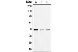 Western blot analysis of BNIP2 expression in HEK293T (A), mouse liver (B), rat liver (C) whole cell lysates. (BNIP2 抗体  (Center))