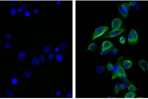 Human pancreatic carcinoma cell line MIA PaCa-2 was stained with Mouse Anti-Cytokeratin 18-UNLB and DAPI. (大鼠 anti-小鼠 IgG2b Antibody (FITC))
