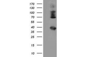 Western Blotting (WB) image for anti-Heat Shock Protein 70 (HSP70) antibody (ABIN1498749) (HSP70 抗体)