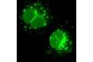 Anti-LEMD3 mouse monoclonal antibody (ABIN2453230) immunofluorescent staining of COS7 cells transiently transfected by pCMV6-ENTRY LEMD3 (RC212759). (LEMD3 抗体)