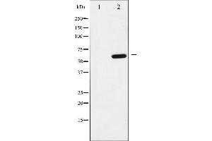 Western blot analysis of p62 Dok phosphorylation expression in K562 whole cell lysates,The lane on the left is treated with the antigen-specific peptide. (DOK1 抗体  (pTyr398))