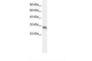 Image no. 2 for anti-Four and A Half LIM Domains 2 (FHL2) (AA 199-248) antibody (ABIN202003) (FHL2 抗体  (AA 199-248))