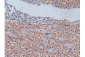 IHC-P analysis of Rat Cerebrum Tissue, with DAB staining. (CXCL1 抗体  (AA 25-96))