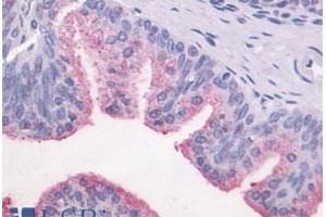 Immunohistochemical (Formalin/PFA-fixed paraffin-embedded sections) staining in human prostate, epithelium with GPR87 polyclonal antibody . (GPR87 抗体  (C-Term))