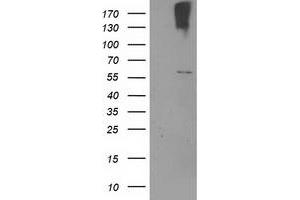 Western Blotting (WB) image for anti-Cytochrome P450, Family 2, Subfamily J, Polypeptide 2 (CYP2J2) antibody (ABIN1497734) (CYP2J2 抗体)