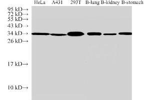 Western Blot analysis of 1)Hela, 2)A431, 3)293T, 4)Bovine lung, 5)Bovine kidney, 6)Bovine stomach using ANXA5 Polyclonal Antibody at dilution of 1:500 (Annexin V 抗体)