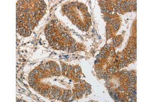 Immunohistochemistry (IHC) image for anti-Progesterone Immunomodulatory Binding Factor 1 (PIBF1) antibody (ABIN3023472) (PIBF1 抗体)