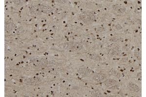ABIN6255514 and ABIN6267208 at 1/100 staining Rat brain tissue by IHC-P. (MECP2 抗体  (pSer80))