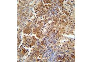 Immunohistochemistry (Paraffin-embedded Sections) (IHC (p)) image for anti-Excision Repair Cross-Complementing Rodent Repair Deficiency, Complementation Group 8 (ERCC8) (AA 210-238), (Middle Region) antibody (ABIN952103)