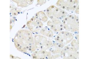 Immunohistochemistry of paraffin-embedded Human stomach using DNAL1 Polyclonal Antibody at dilution of 1:100 (40x lens). (DNAL1 抗体)