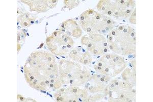 Immunohistochemistry of paraffin-embedded Human stomach using DNAL1 Polyclonal Antibody at dilution of 1:100 (40x lens). (DNAL1 抗体)