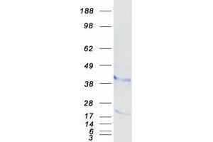 Western Blotting (WB) image for Bone Marrow Stromal Cell Antigen 1 (BST1) protein (Myc-DYKDDDDK Tag) (ABIN2713447)
