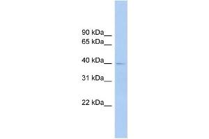 WB Suggested Anti-FCRLA Antibody Titration:  0. (FCRLA 抗体  (Middle Region))