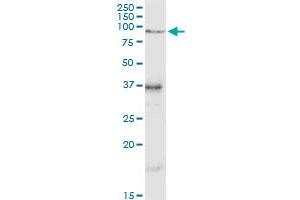 Western Blotting (WB) image for anti-Vascular Cell Adhesion Molecule 1 (VCAM1) (AA 1-739) antibody (ABIN950049)
