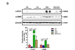 Calcipotriol alleviates DDC-induced liver injury and fibrosis. (COL1A1 抗体  (AA 100-200))